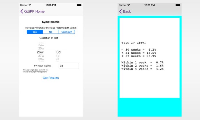 Aplikace QUiPP pro odhalení rizika předčasného porodu